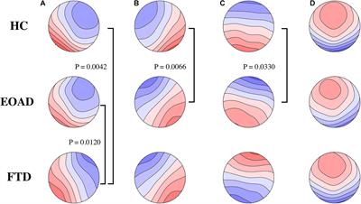 Differences in Multimodal Electroencephalogram and Clinical Correlations Between Early-Onset Alzheimer’s Disease and Frontotemporal Dementia